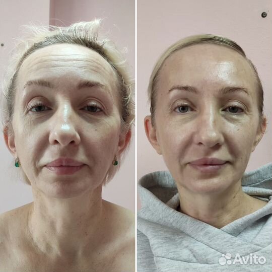 Массаж лица по техники эффект фотошопа