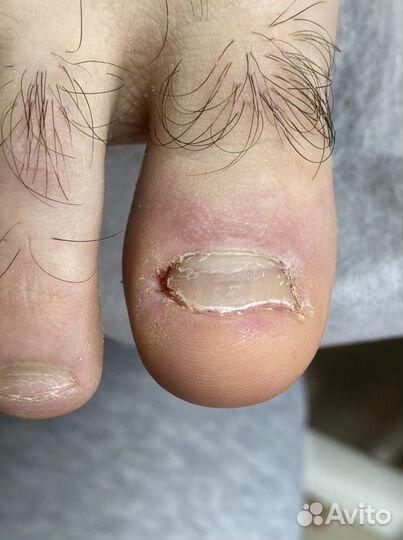 Подолог самара