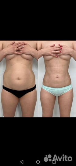 Это не LPG, это Vela Shape)