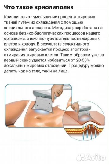 Криолиполиз