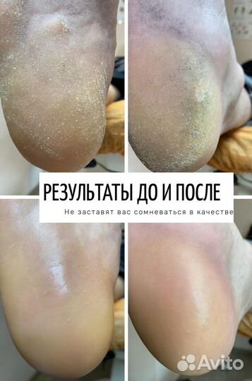 Маникюр и педикюр