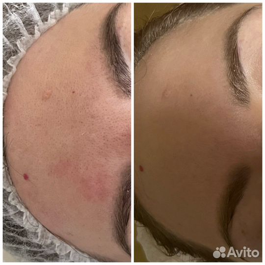 Нужны модели коррекция фигуры/массаж спины