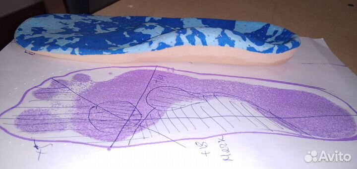 Изготовление индивидуальных стелек