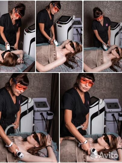 Лазерная эпиляция