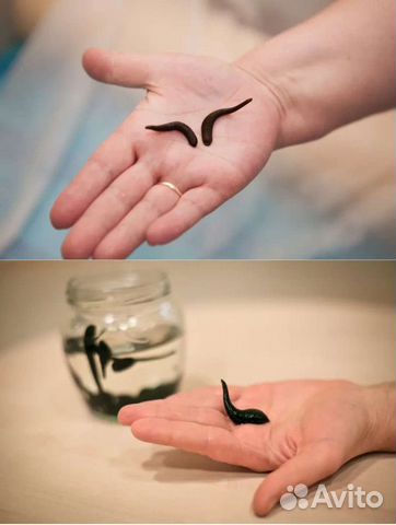 Пиявки гирудотерапия