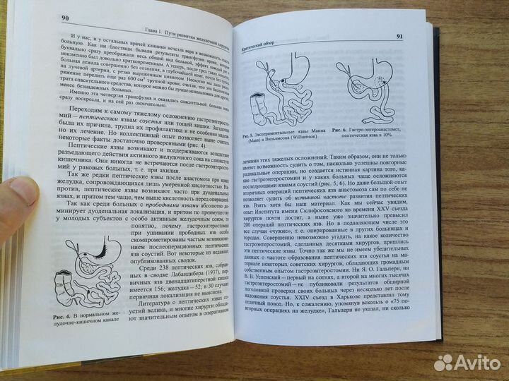 Этюды желудочной хирургии С. С. Юдин