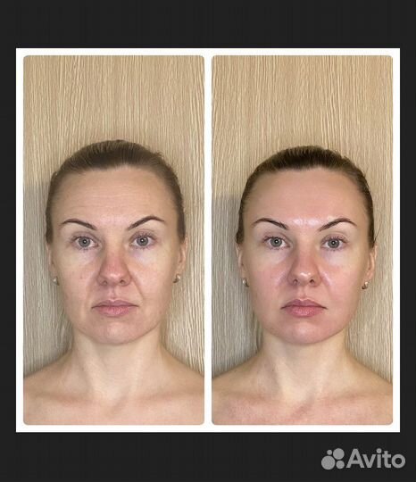 Массаж/ энергомассаж/лицо/тело