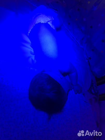 Лампа от желтушки