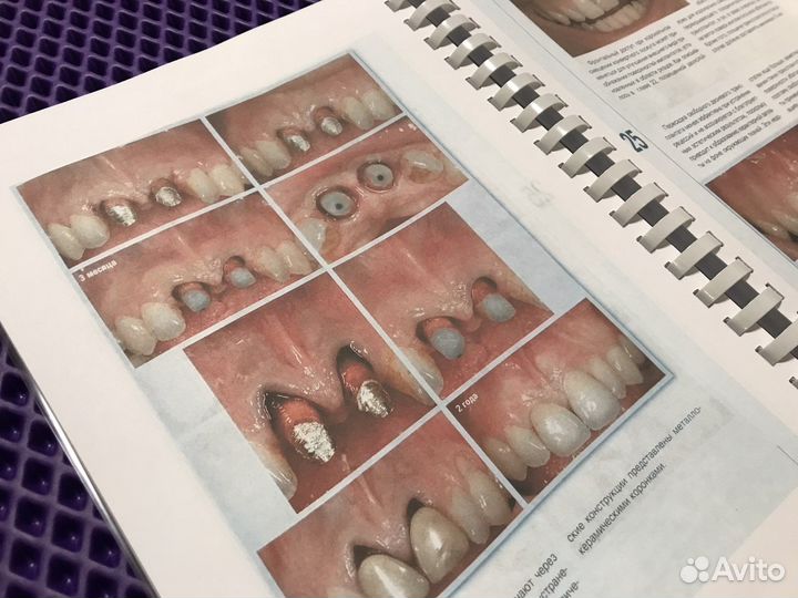 Пластическая хирургия мягких тканей полости рта