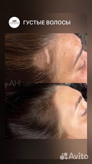 Стрижка женская