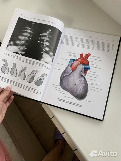 Атлас анатомии Синельникова том 3