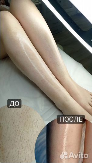 Депиляция в студии