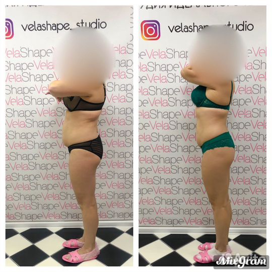 Массаж Похудение Коррекция фигуры Косметолог