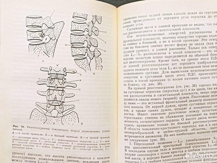 Болезни периферической нервной системы.1989