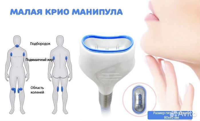 Криолиполиз, смас-липосакция