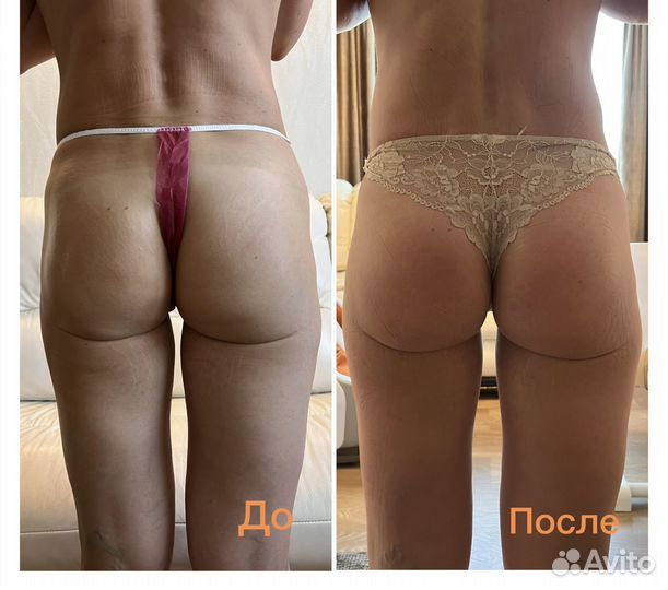 Виски-пеленание styx,гелевое обертывание cello-GEL