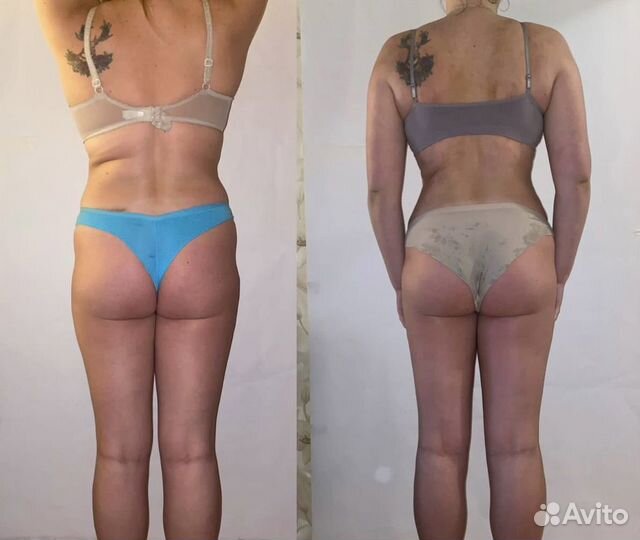 Массаж для похудения