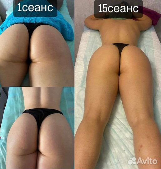 Массаж на дому