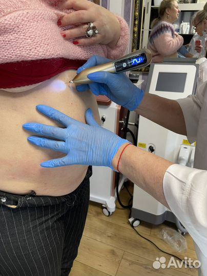 Электрокаогуляция новообразований на лице и теле