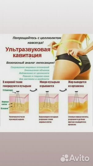 LPG массаж