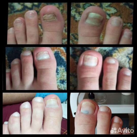 Мастер педикюра, подология