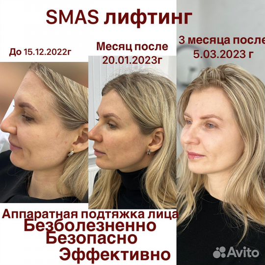 Аппаратная мезотерапия