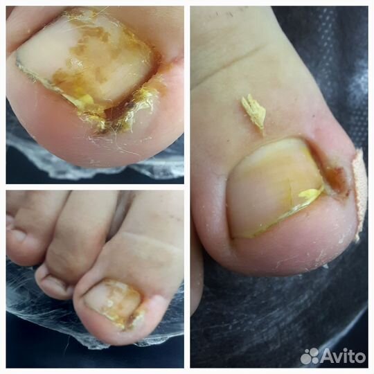 Подолог, педикюр, маникюр