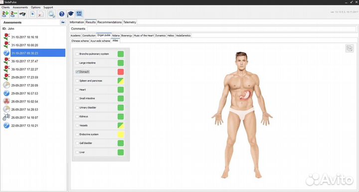 Ищем Модель - Спортивный массаж