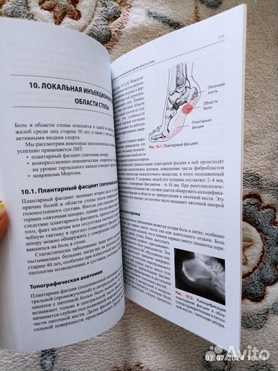 Книги по неврологии