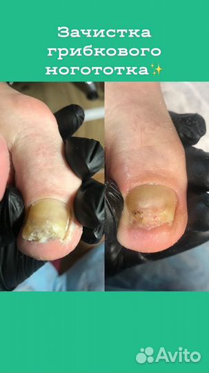 Мастер педикюра, Подолог