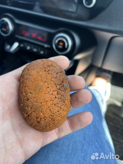 Желчный камень