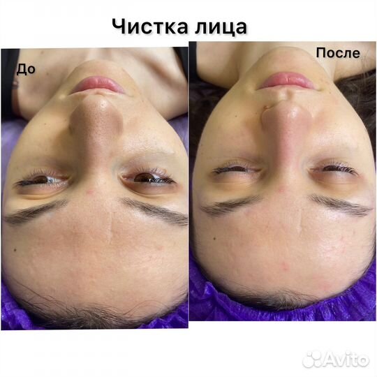 Косметолог в центре