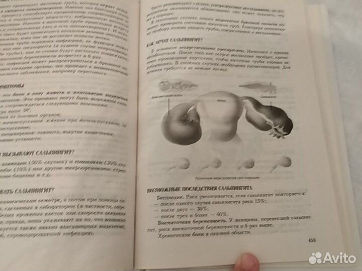 Анна де Кервасдуэ (девочка, девушка,женщина)