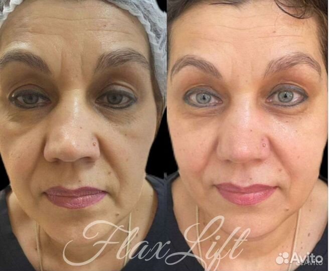 Обучение/курсы косметолог эстетист FlaxLift