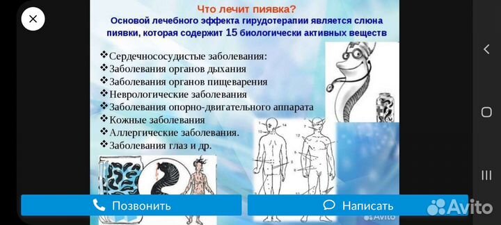 Пиявки медицинские