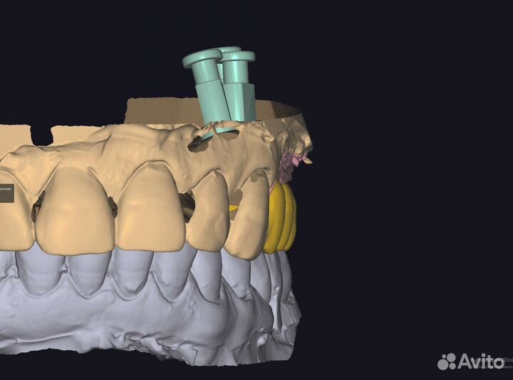 Зуботехническая лаборатория