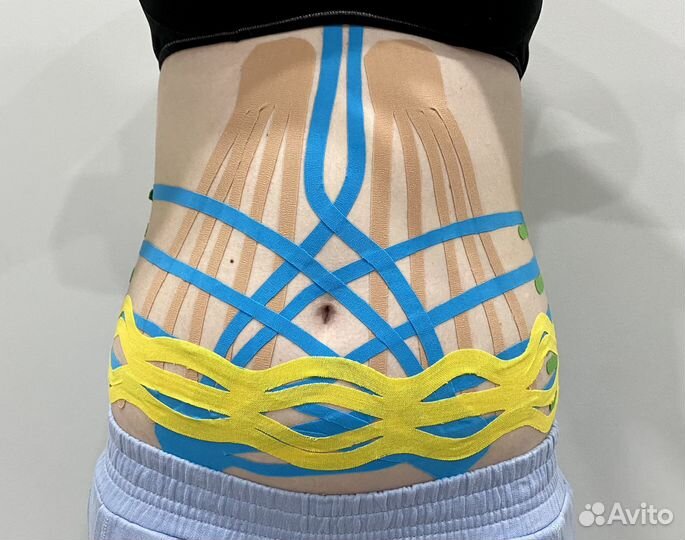 Тейпирование эстетическое и терапевтическое