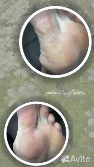 Педикюр с покрытием гель-лаком