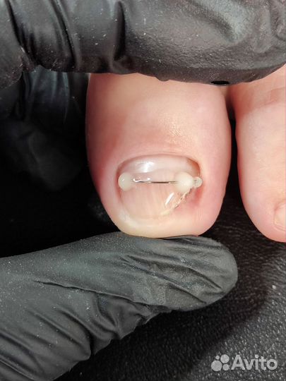 Наращивание ногтей