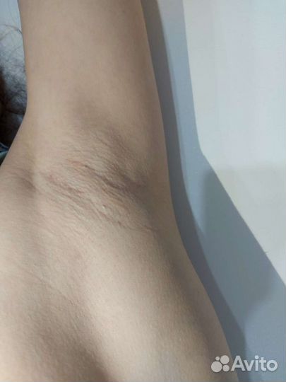 Шугаринг,воск