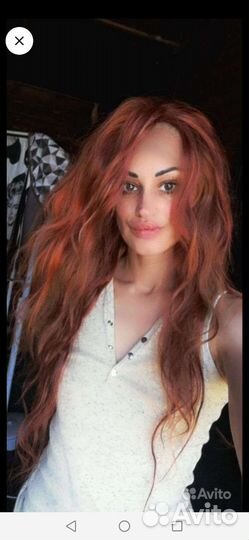 Система замещения волос