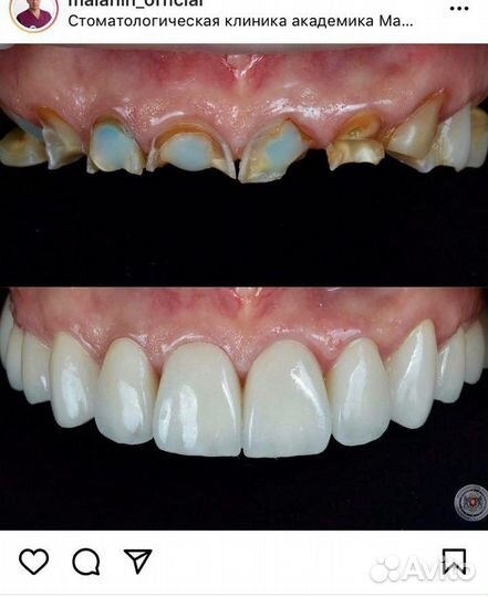 Зубной техник, керамист, exocad, заведующий зтл