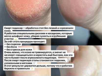 Педикюр с покрытием гель лак, Щербинка