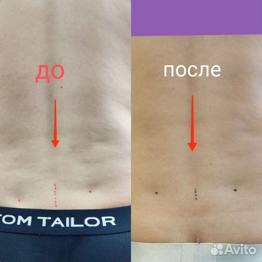 Испанский массаж, висцеральная терапия