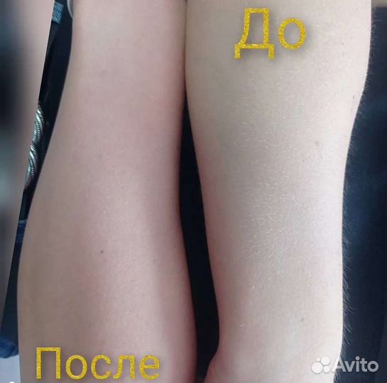 Шугаринг/Воск