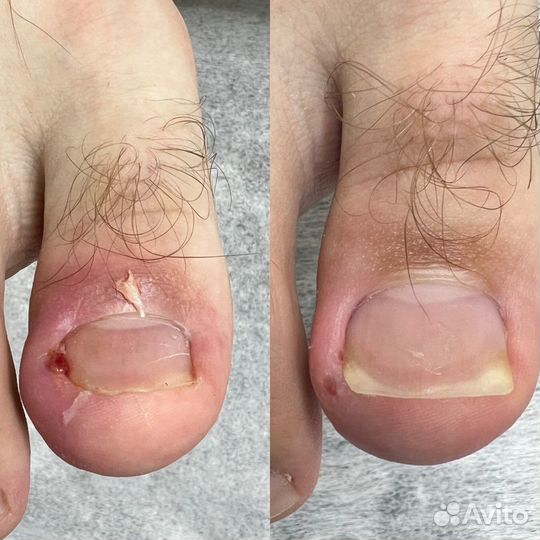 Подолог с медобразованием