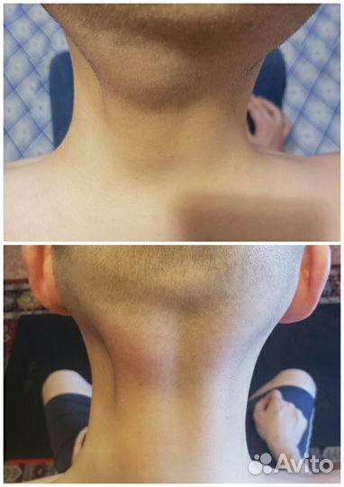 Массаж костоправ