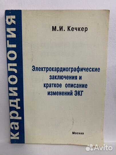 Электрокардиогафические заключения. Кечкер