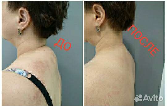 Массаж Туйна.Лечебный,мануальный,спортивный,детям