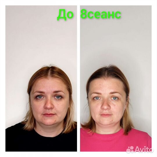 Лифтинг-массаж лица